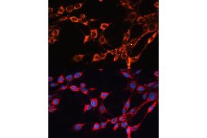 Immunofluorescence analysis of NIH/3T3 cells using SLC25 antibody (ABIN6132661, ABIN6147921, ABIN6147922 and ABIN6215721) at dilution of 1:100. (SLC25A24 antibody  (AA 1-200))