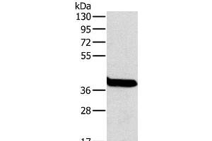 Western Blot analysis of Mouse liver tissue using OTC Polyclonal Antibody at dilution of 1:800