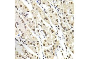Immunohistochemistry of paraffin-embedded human stomach using SOX5 antibody at dilution of 1:100 (x400 lens). (SOX5 antibody)