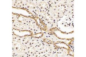 Immunohistochemistry of paraffin embedded rat kidney using EP0 (ABIN7073860) at dilution of 1: 900 (400x lens) (EPO antibody)