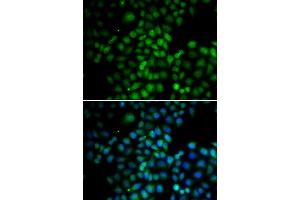 Immunofluorescence analysis of HeLa cells using C11orf30 antibody. (EMSY antibody)