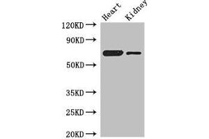 Western Blot Positive WB detected in: Mouse heart tissue, Mouse kidney tissue All lanes: ETFDH antibody at 3 μg/mL Secondary Goat polyclonal to rabbit IgG at 1/50000 dilution Predicted band size: 69, 63 kDa Observed band size: 69 kDa (ETFDH antibody  (AA 34-617))