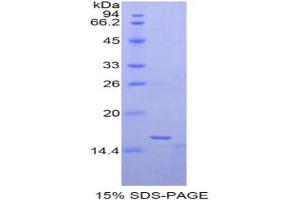 SDS-PAGE analysis of Human Matrix Gla Protein. (MGP Protein)