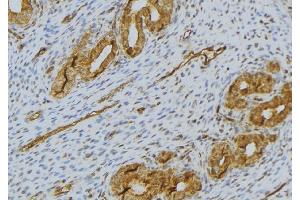 ABIN6276503 at 1/100 staining Human uterus tissue by IHC-P.