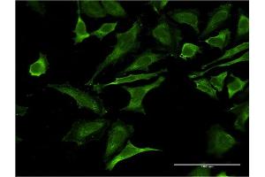 Immunofluorescence of monoclonal antibody to OCLN on HeLa cell.