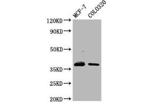 Western Blot Positive WB detected in: MCF-7 whole cell lysate, Colo320 whole cell lysate All lanes: PGLYRP3 antibody at 4. (PGLYRP3 antibody  (AA 90-222))