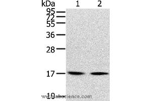 Western blot analysis of Human normal liver tissue and hepg2 cell, using RPLP1 Polyclonal Antibody at dilution of 1:400 (RPLP1 antibody)