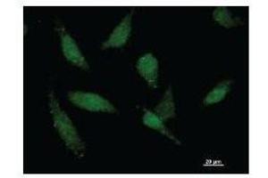 Immunostaining analysis in HeLa cells.