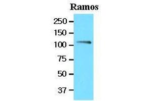 Cell lysates of Ramos (20 ug) were resolved by SDS-PAGE, transferred to nitrocellulose membrane and probed with anti-human NFATc1 (1:1000). (NFATC1 antibody  (AA 428-716))