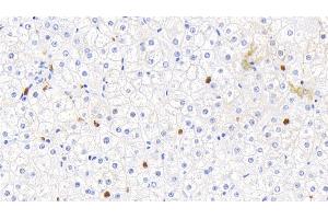 Detection of CALPRO in Human Liver Tissue using Polyclonal Antibody to Calprotectin (CALPRO) (Calprotectin antibody  (AA 1-114))