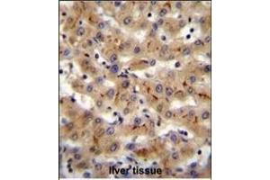 CSAD Antibody (Center) (ABIN655728 and ABIN2845175) immunohistochemistry analysis in formalin fixed and paraffin embedded human liver tissue followed by peroxidase conjugation of the secondary antibody and DAB staining. (CSAD antibody  (AA 197-226))