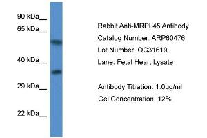 Western Blotting (WB) image for anti-Mitochondrial Ribosomal Protein L45 (MRPL45) (C-Term) antibody (ABIN2788460) (MRPL45 antibody  (C-Term))