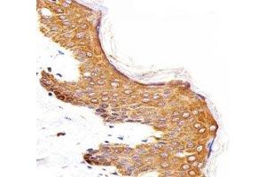 IHC analysis of FFPE human skin section using Epidermal Growth Factor Receptor antibody; Ab was diluted at 1:25.