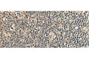Immunohistochemistry of paraffin-embedded Human tonsil tissue using PRKRA Polyclonal Antibody at dilution of 1:65(x200) (PRKRA antibody)