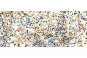 WNT2 antibody