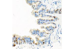 Immunohistochemistry of paraffin-embedded mouse lung using RGS5 antibody at dilution of 1:100 (x40 lens). (RGS5 antibody)
