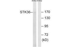 Western blot analysis of extracts from K562 cells, using STK36 antibody. (STK36 antibody)