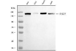Western blot analysis of Desmoglein 2/DSG2 using anti-Desmoglein 2/DSG2 antibody (ABIN7600804). (Desmoglein 2 antibody  (AA 24-1020))