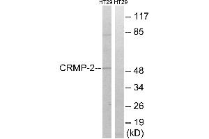Immunohistochemistry analysis of paraffin-embedded human brain tissue using CRMP-2 (Ab-509) antibody.
