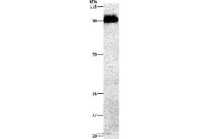 Western blot analysis of Mouse brain tissue, using APP Polyclonal Antibody at dilution of 1:1000 (beta Amyloid antibody)