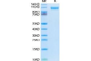 PTGFRN Protein (AA 22-832) (His tag)