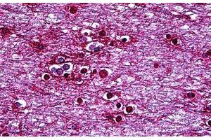 Human Brain, Cortex: Formalin-Fixed, Paraffin-Embedded (FFPE) (HMX2 antibody  (AA 125-224))