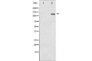 Western blot analysis of SREBP-1 phosphorylation expression in TNF treated Jurkat whole cell lysates,The lane on the left is treated with the antigen-specific peptide. (SREBF1 antibody  (pSer439))