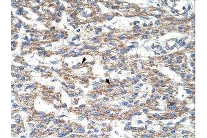 Immunohistochemistry (IHC) image for anti-Deoxyuridine Triphosphatase (DUT) (C-Term) antibody (ABIN2782436) (Deoxyuridine Triphosphatase (DUT) (C-Term) antibody)