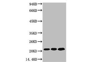 Western blot analysis of 1) MCF7, 2) Rat Kidney Tissue, 3) Mouse Brain Tissue, diluted at 1:2000. (Peroxiredoxin 1 antibody)