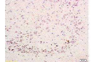 Formalin-fixed and paraffin embedded rat brain labeled with Rabbit Anti-CDK5 Polyclonal Antibody  at 1:200 followed by conjugation to the secondary antibody and DAB staining. (CDK5 antibody  (AA 15-100))