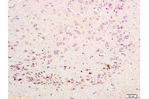 Formalin-fixed and paraffin embedded rat brain labeled with Rabbit Anti-CDK5 Polyclonal Antibody  at 1:200 followed by conjugation to the secondary antibody and DAB staining. (CDK5 antibody  (AA 15-100))