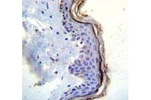 c-Kit antibody immunohistochemistry analysis in formalin fixed and paraffin embedded human skin tissue.