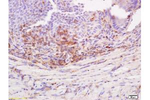 Formalin-fixed and paraffin embedded rat tongue labeled with Anti-Desmoglein 3/DSG3 Polyclonal Antibody, Unconjugated (ABIN718451) at 1:200 followed by conjugation to the secondary antibody (Desmoglein 3 antibody  (AA 50-75))