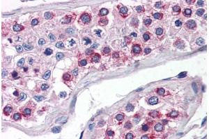 Human Testis (formalin-fixed, paraffin-embedded) stained with ATG16L1 antibody ABIN351446 at 5 ug/ml followed by biotinylated goat anti-rabbit IgG secondary antibody ABIN481713, alkaline phosphatase-streptavidin and chromogen. (ATG16L1 antibody  (N-Term))