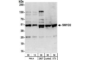 Western Blotting (WB) image for anti-SET and MYND Domain Containing 2a (SMYD2A) (AA 383-433) antibody (ABIN7450750)