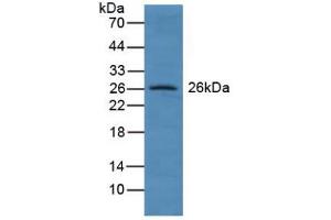 Figure. (GSTA4 antibody  (AA 3-222))