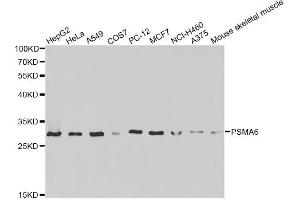 Western blot analysis of extracts of various cell lines, using PSMA6 antibody (ABIN6292835) at 1:1000 dilution. (PSMA6 antibody)