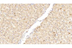 Detection of WNK1 in Human Liver Tissue using Polyclonal Antibody to WNK Lysine Deficient Protein Kinase 1 (WNK1) (WNK1 antibody  (AA 1954-2231))