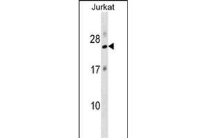 RPL18 Antibody (N-term) (ABIN1538828 and ABIN2849097) western blot analysis in Jurkat cell line lysates (35 μg/lane). (RPL18 antibody  (N-Term))
