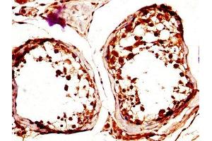 IHC image of ABIN7146077 diluted at 1:600 and staining in paraffin-embedded human testis tissue performed on a Leica BondTM system. (CLEC4E antibody  (AA 41-219))