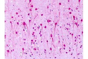 Anti-GPR1 antibody IHC of human brain, neurons. (G Protein-Coupled Receptor 1 antibody  (N-Term))