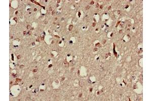 Immunohistochemistry of paraffin-embedded human brain tissue using ABIN7160025 at dilution of 1:100 (MAP3K13 antibody  (AA 506-835))