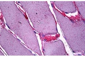 Human Skeletal Muscle, Interstitial Cells: Formalin-Fixed, Paraffin-Embedded (FFPE) (SFRP4 antibody  (AA 239-253))