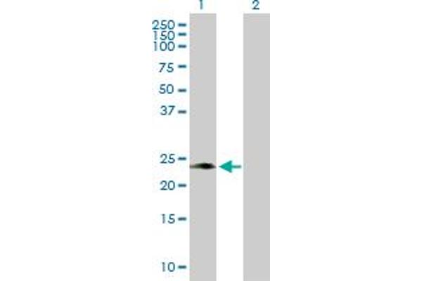 PAEP antibody  (AA 1-180)