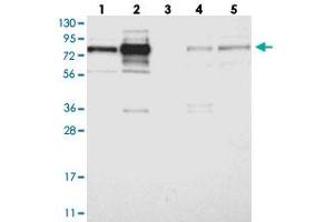 Western blot analysis of Lane 1: RT-4, Lane 2: U-251 MG, Lane 3: Human Plasma, Lane 4: Liver, Lane 5: Tonsil with GRAMD1C polyclonal antibody . (GRAMD1C antibody)