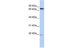 WB Suggested Anti-C7orf38 Antibody Titration: 0. (FAM200A antibody  (Middle Region))