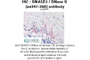 Image no. 2 for anti-Deoxyribonuclease II, Lysosomal (DNASE2) (AA 347-360) antibody (ABIN1733721) (DNASE2 antibody  (AA 347-360))