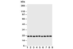 Western blot testing of Cytoglobin antibody and Lane 1:  rat brain (CYGB antibody  (N-Term))