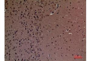 Immunohistochemistry (IHC) analysis of paraffin-embedded Mouse Brain, antibody was diluted at 1:100. (INPPL1 antibody  (Internal Region))