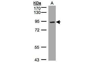 WB Image Sample(30 ug whole cell lysate) A:Hep G2 , 7. (LRP12 antibody  (C-Term))